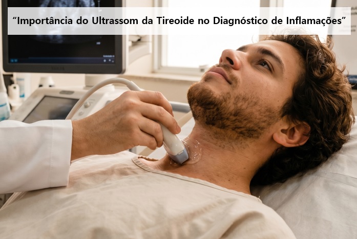 Um homem brasileiro deitado em uma maca hospitalar passando por um exame de ultrassom no pescoço realizado por um médico, com a tela do aparelho exibindo a imagem da glândula tireoide com tireoidite subaguda.